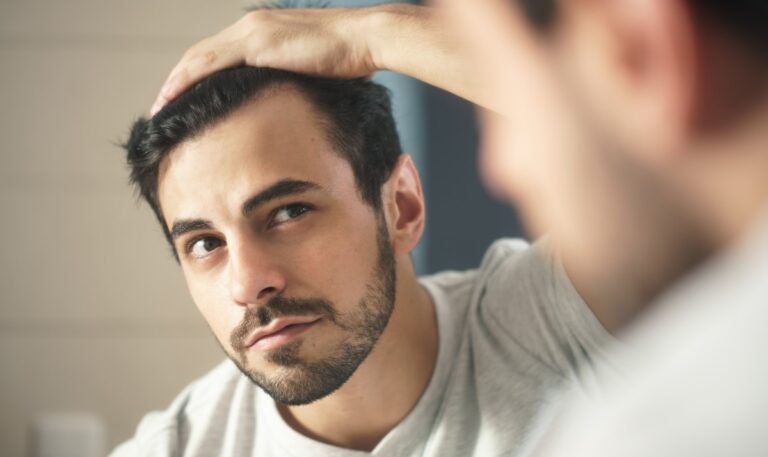 Capelli grassi? Nessun problema! Semplici soluzioni per una chioma impeccabile